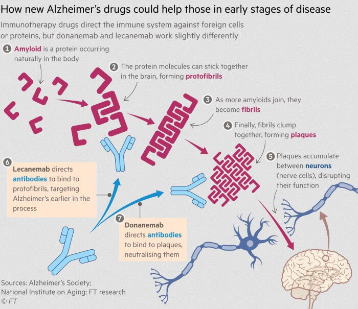 donanemab help to alzheimer disease